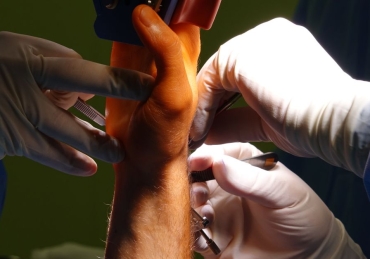 Abdutor pollicis longus Ir para: navegação, pesquisa