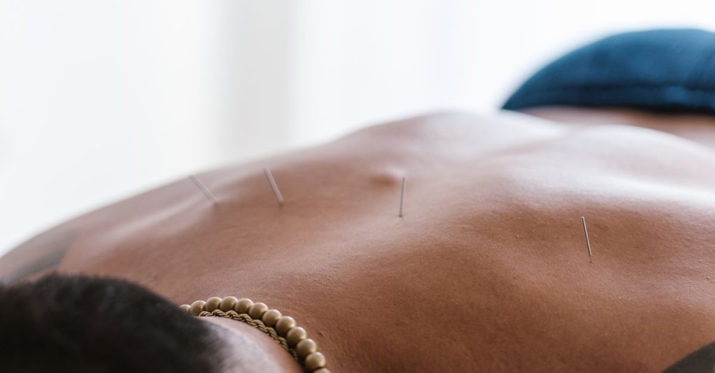 Confira artigo sobre a Técnica de Dry Needling