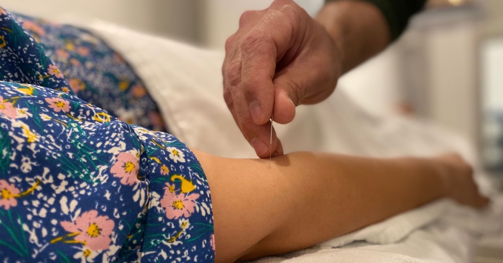 Contra-indicações de acupuntura Ir para: navegação, pesquisa
