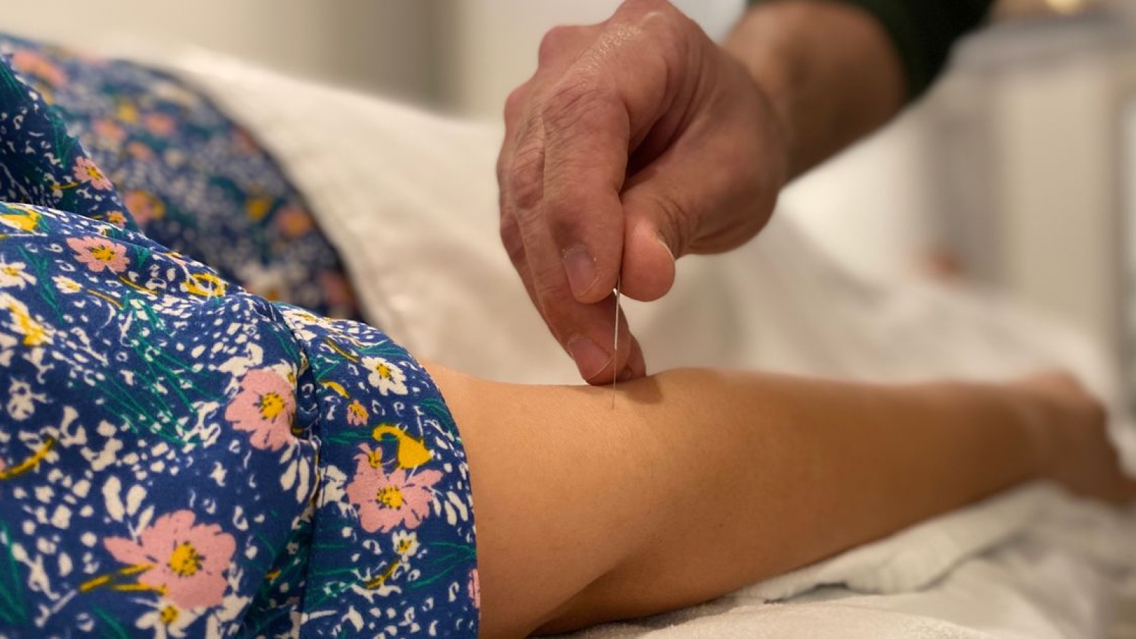 Contra-indicações de acupuntura Ir para: navegação, pesquisa