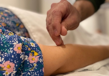 Contra-indicações de acupuntura Ir para: navegação, pesquisa