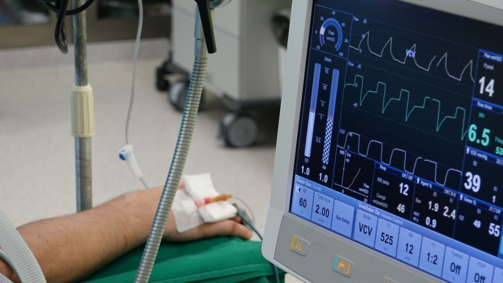 Escala de recuperação de coma (revisada) Ir para: navegação, pesquisa