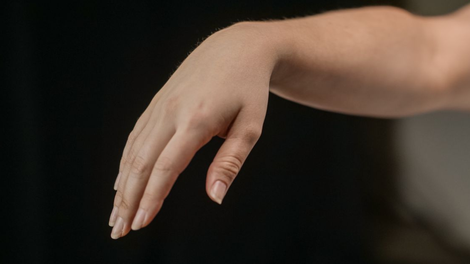 Extensor radial do carpo longo Ir para: navegação, pesquisa