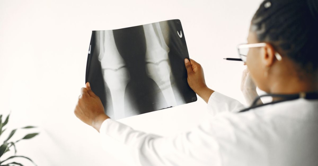 Fisioterapia Ortopédica o que é e o que faz a Fisioterapia Ortopédica?