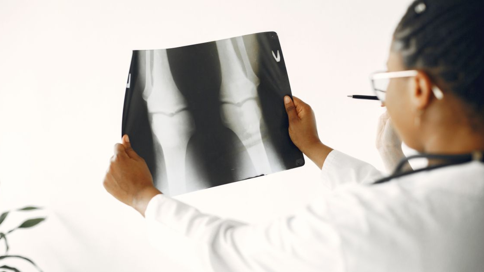 Fisioterapia Ortopédica o que é e o que faz a Fisioterapia Ortopédica?
