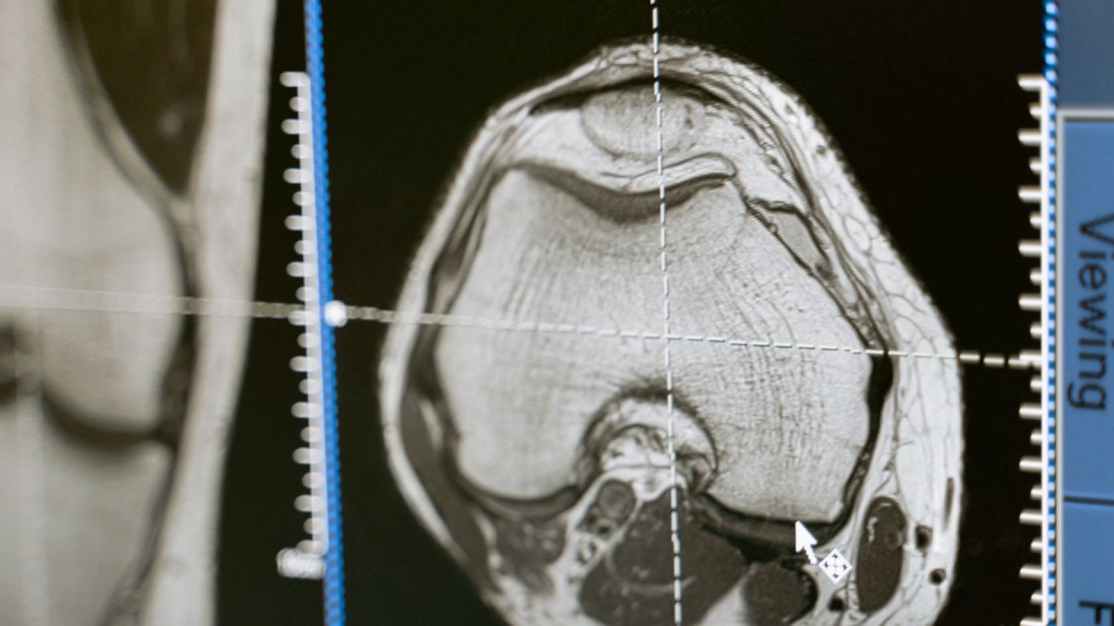 Ligamento longitudinal anterior Ir para: navegação, pesquisa