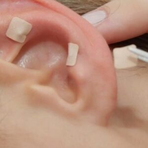 Curso de Auriculoterapia