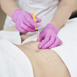 Intradermoterapia Injetável