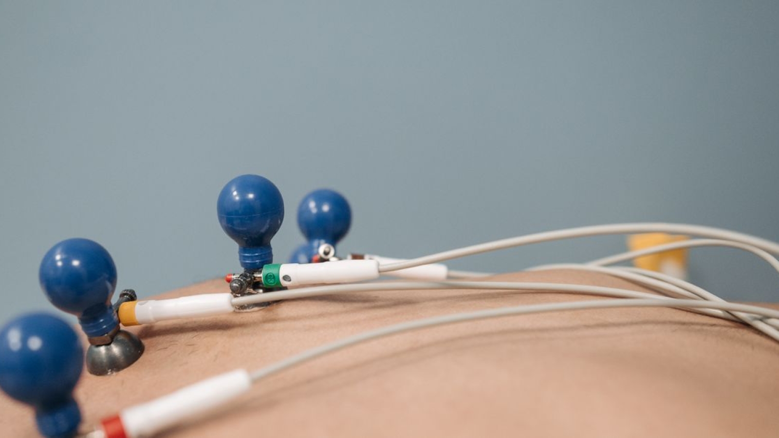 Auscultação: Técnicas e Sons Pulmonares e Cardíacos