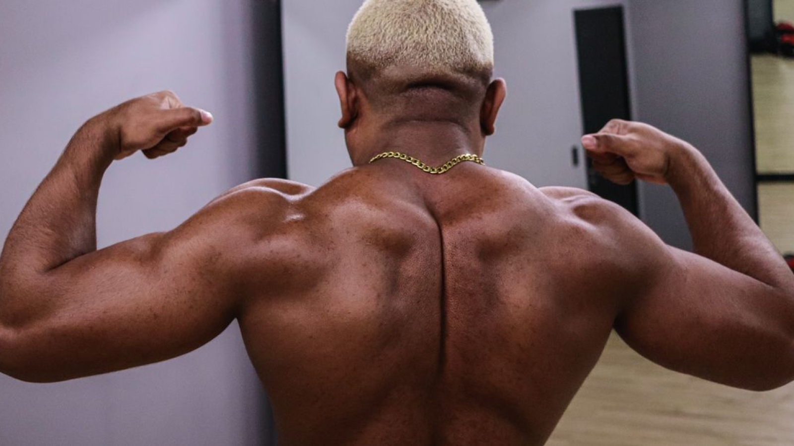Contusão Muscular Quadríceps
