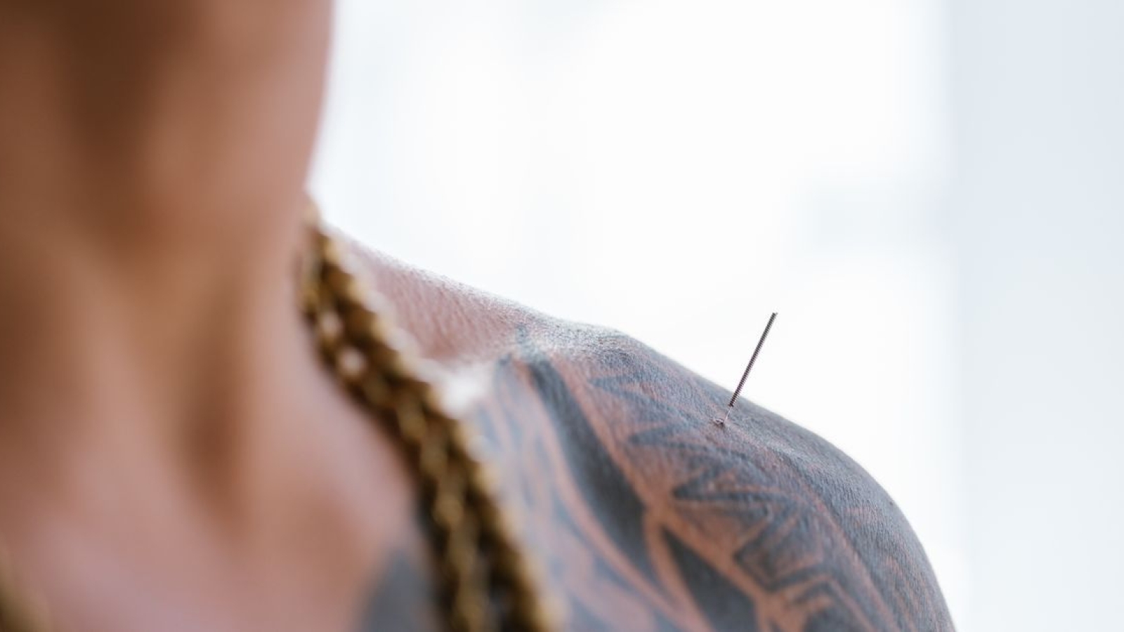 Dry Needling: A Técnica de Agulhamento Seco na Fisioterapia