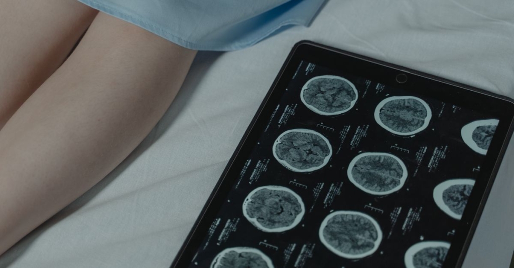 Fisioterapia neurológica
