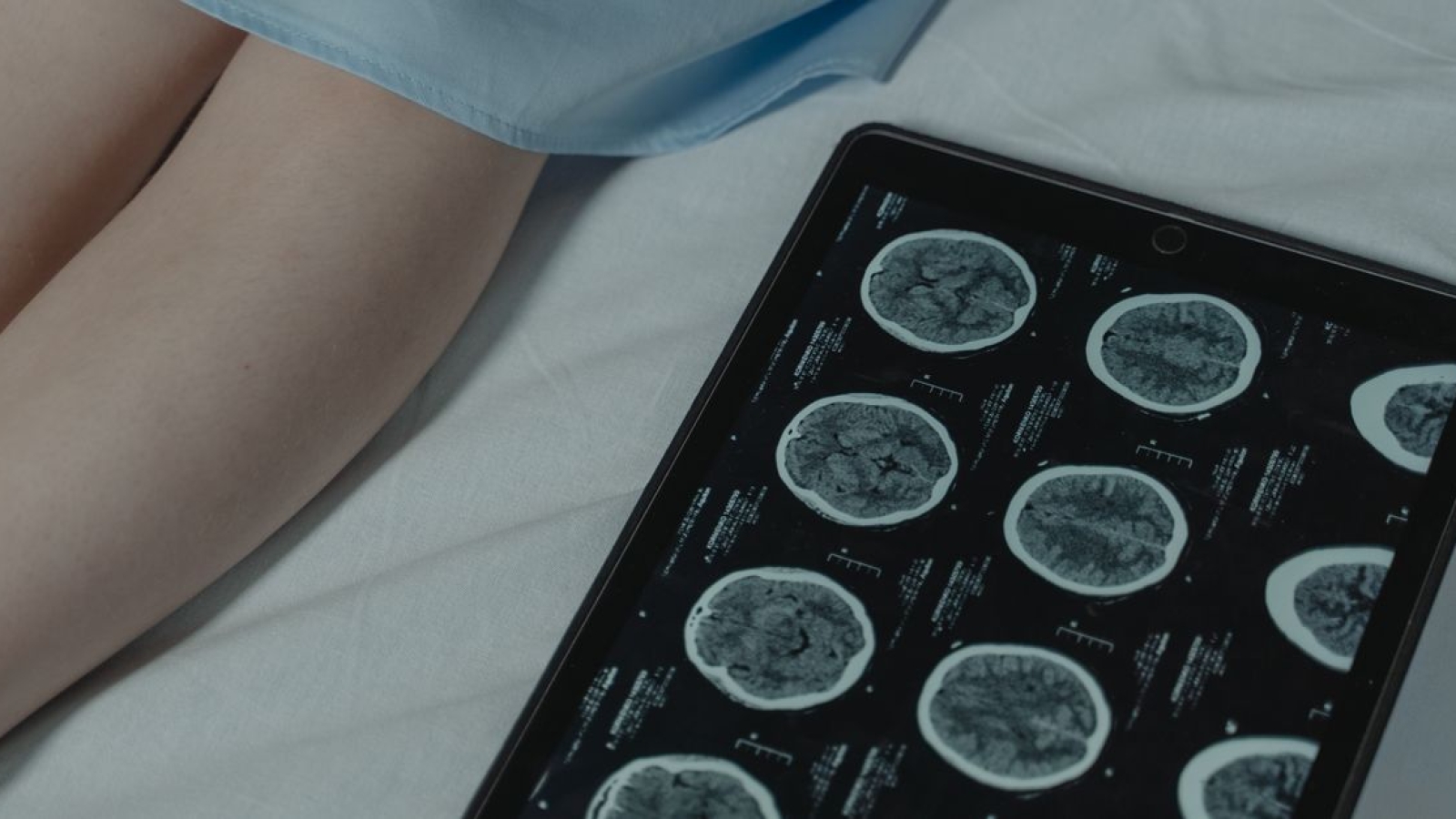 Fisioterapia neurológica