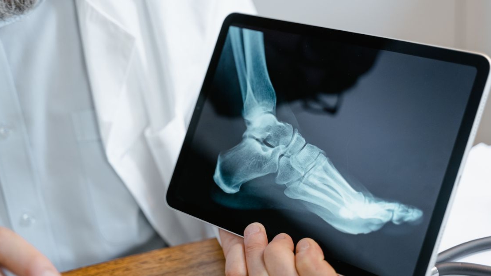 Lesão do Ligamento Lateral do Tornozelo