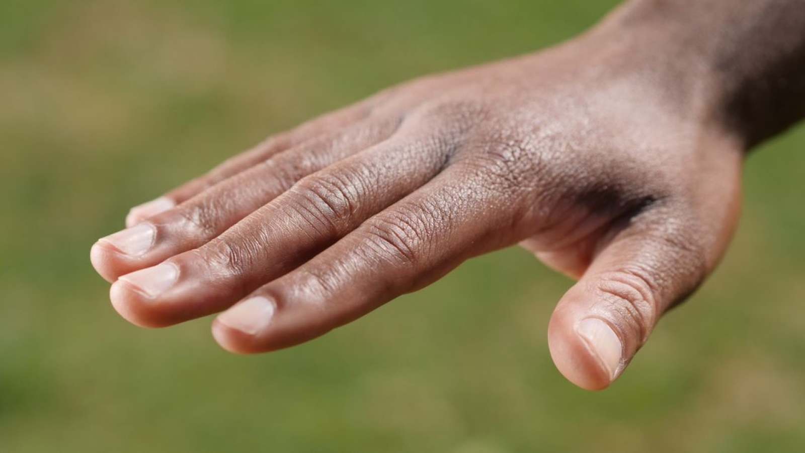 Lesões do tendão extensor dos dedos e mão