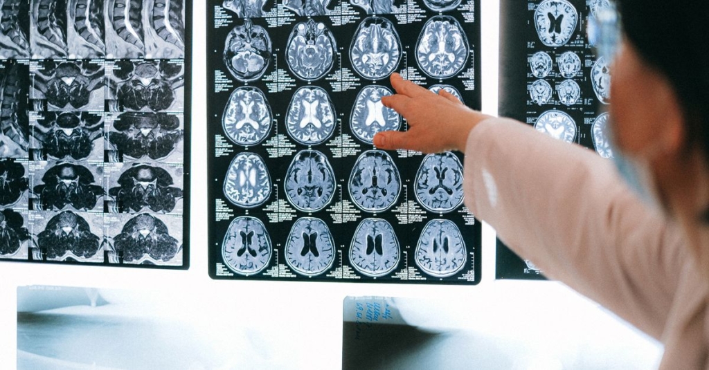 Padrões Internacionais para Classificação Neurológica da Lesão Medular (ISNCSCI)