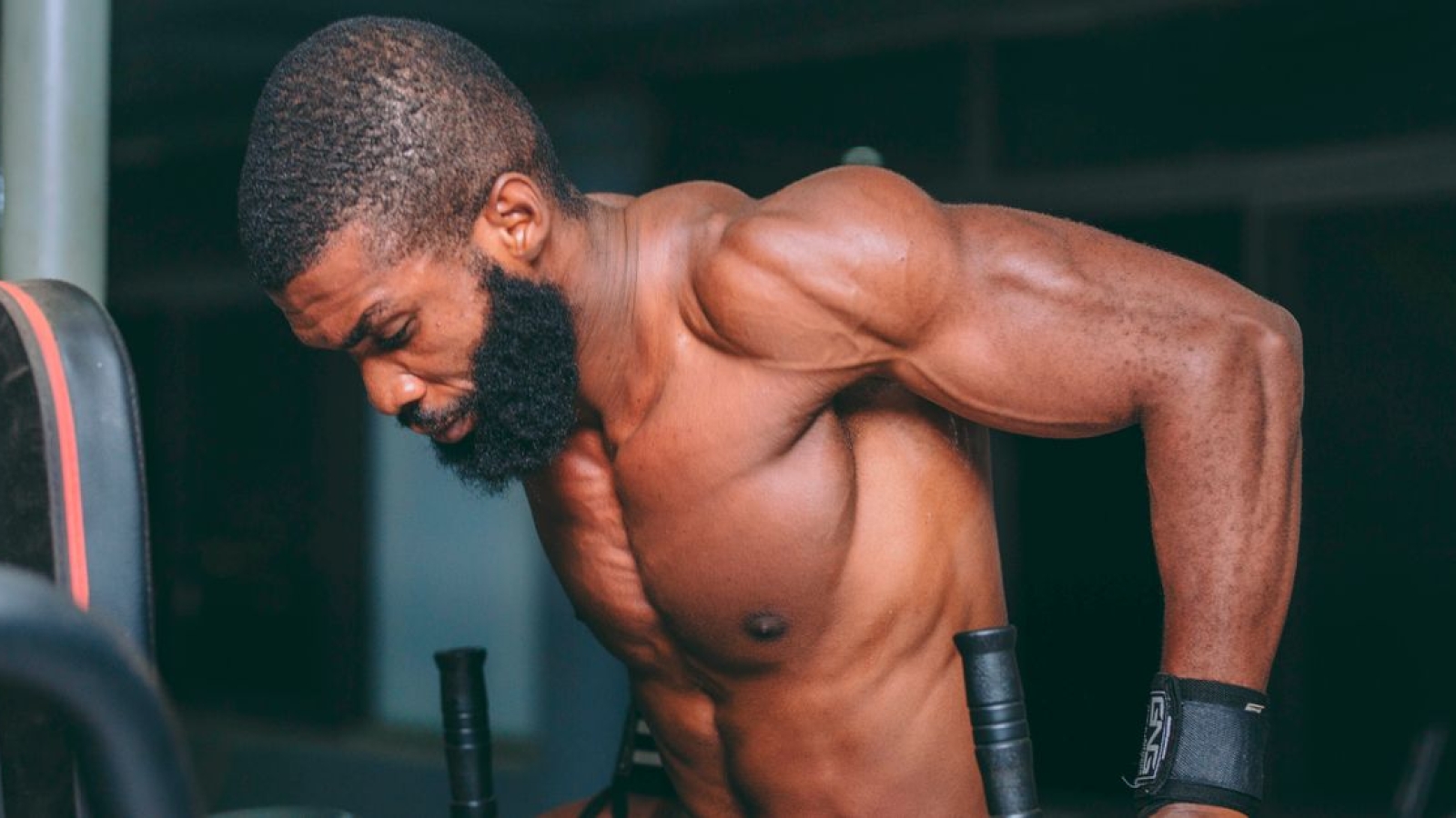 Ruptura do músculo Triceps Brachii