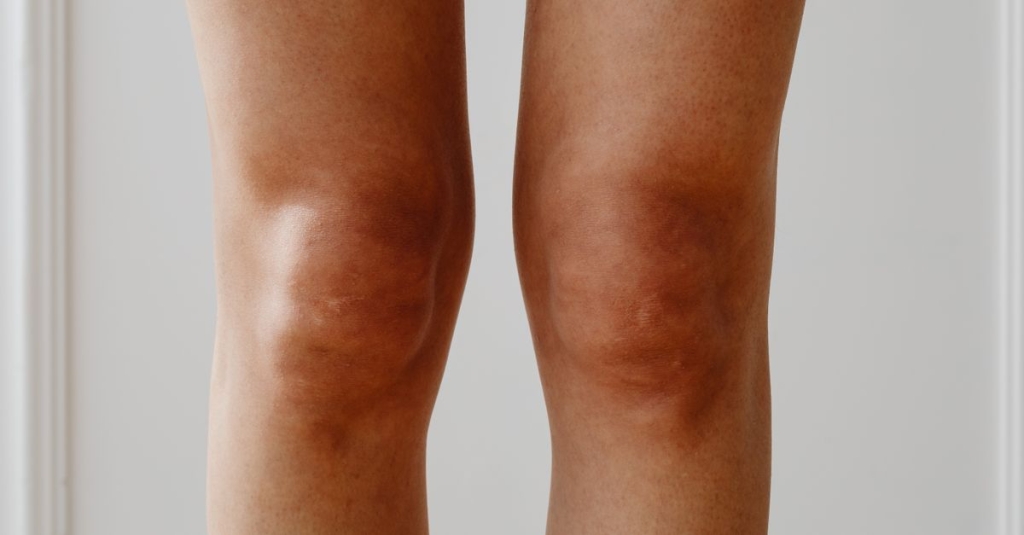 Teste de gaveta posterior (joelho)