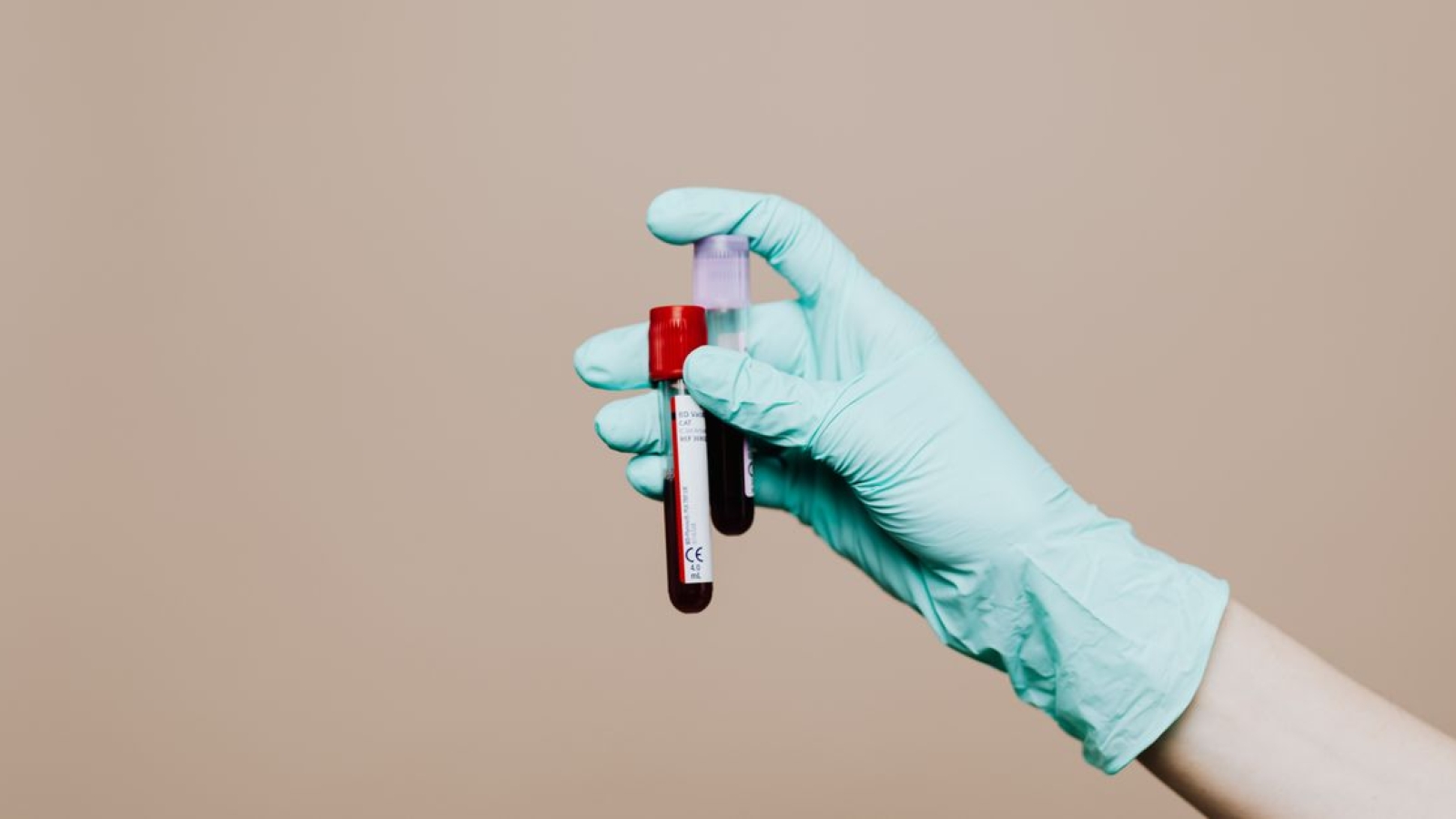 Teste de Neer – Testes especiais para Ombro – Teste do impacto de Neer